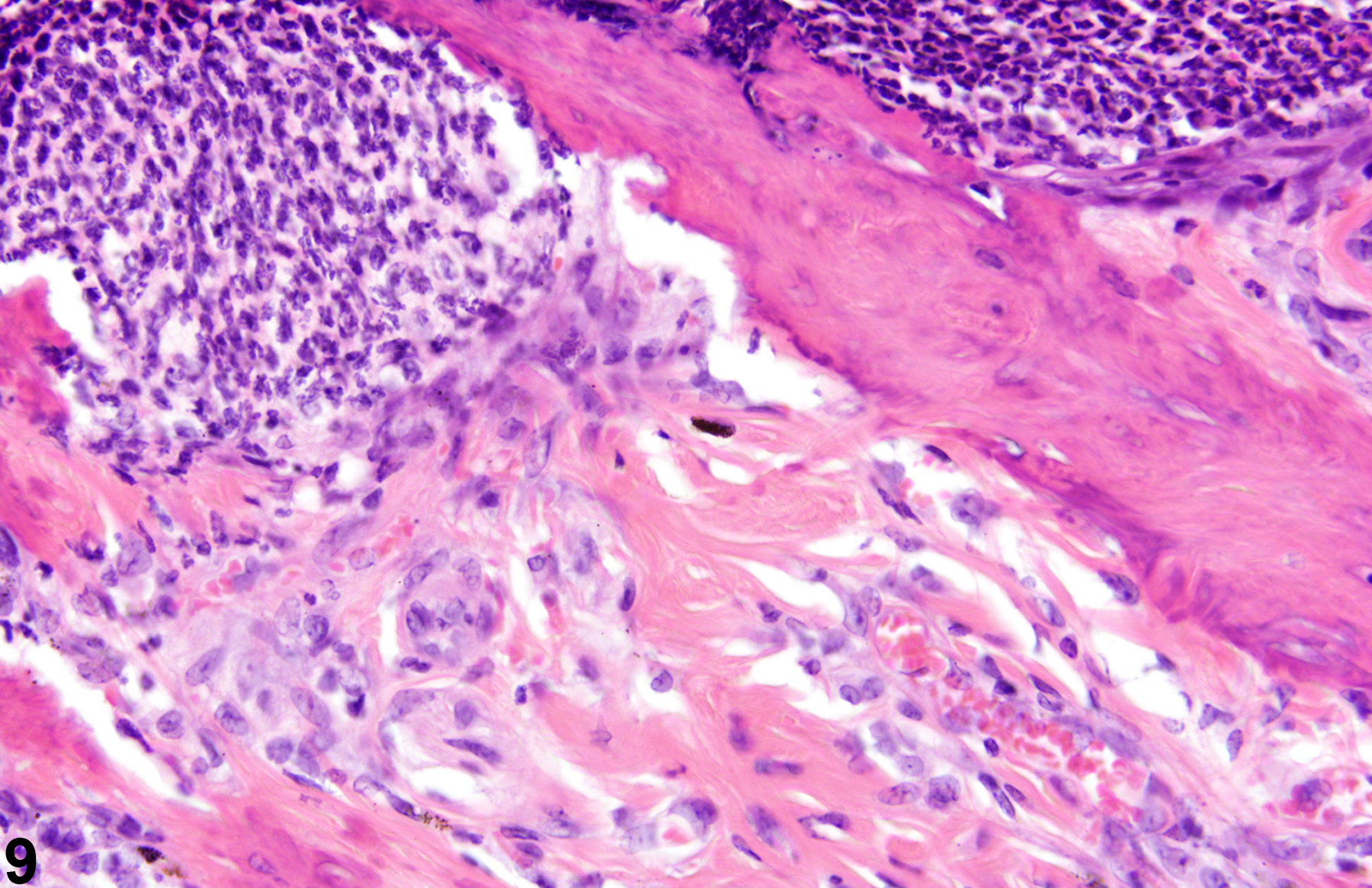 Inflammation Regulation